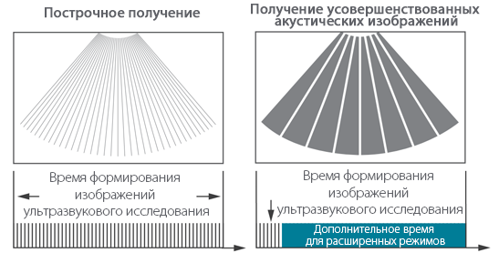 Сравнение послойного и построчного уз-исследования
