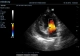 Фото Mindray DC-N3 Vet