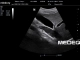 Фото Mindray 3C5s
