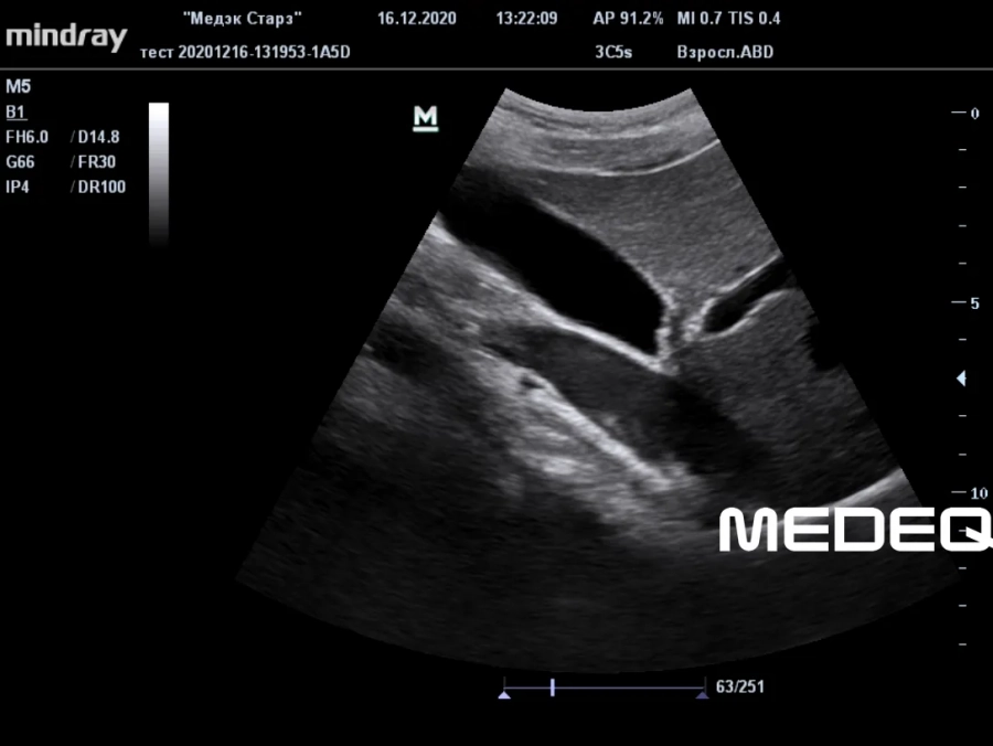 Фото Mindray 3C5s