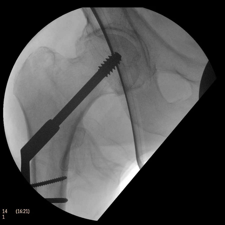 Фото Philips BV Endura