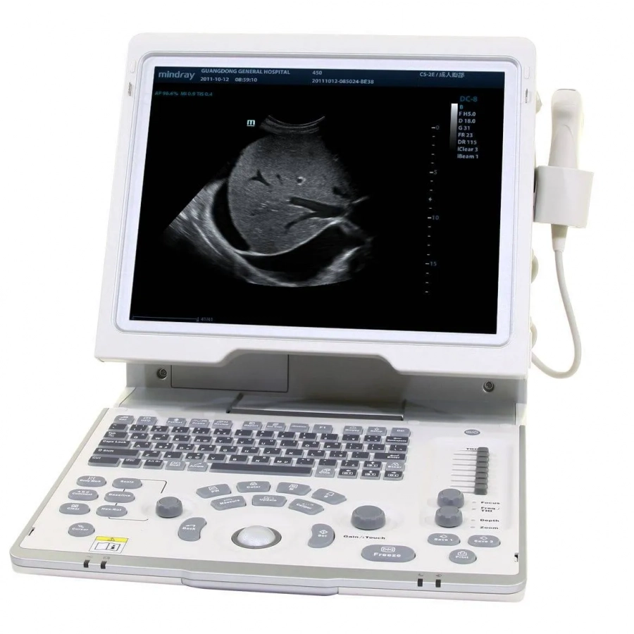 Фото Mindray DP-50