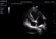 Фото Mindray DC-N3 Vet