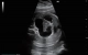Фото Mindray Imagyn i9