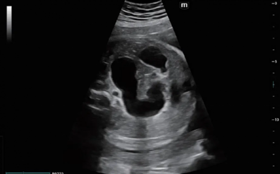 Фото Mindray Imagyn i9
