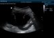Фото Mindray DP-50
