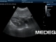 Фото Mindray 35C50EA