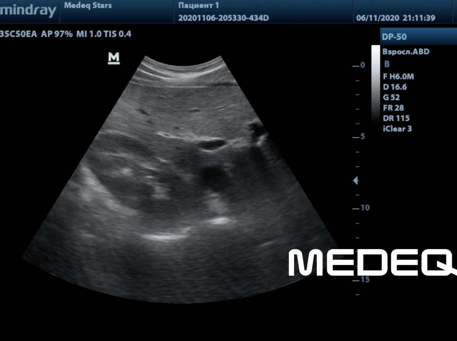 Фото Mindray 35C50EA
