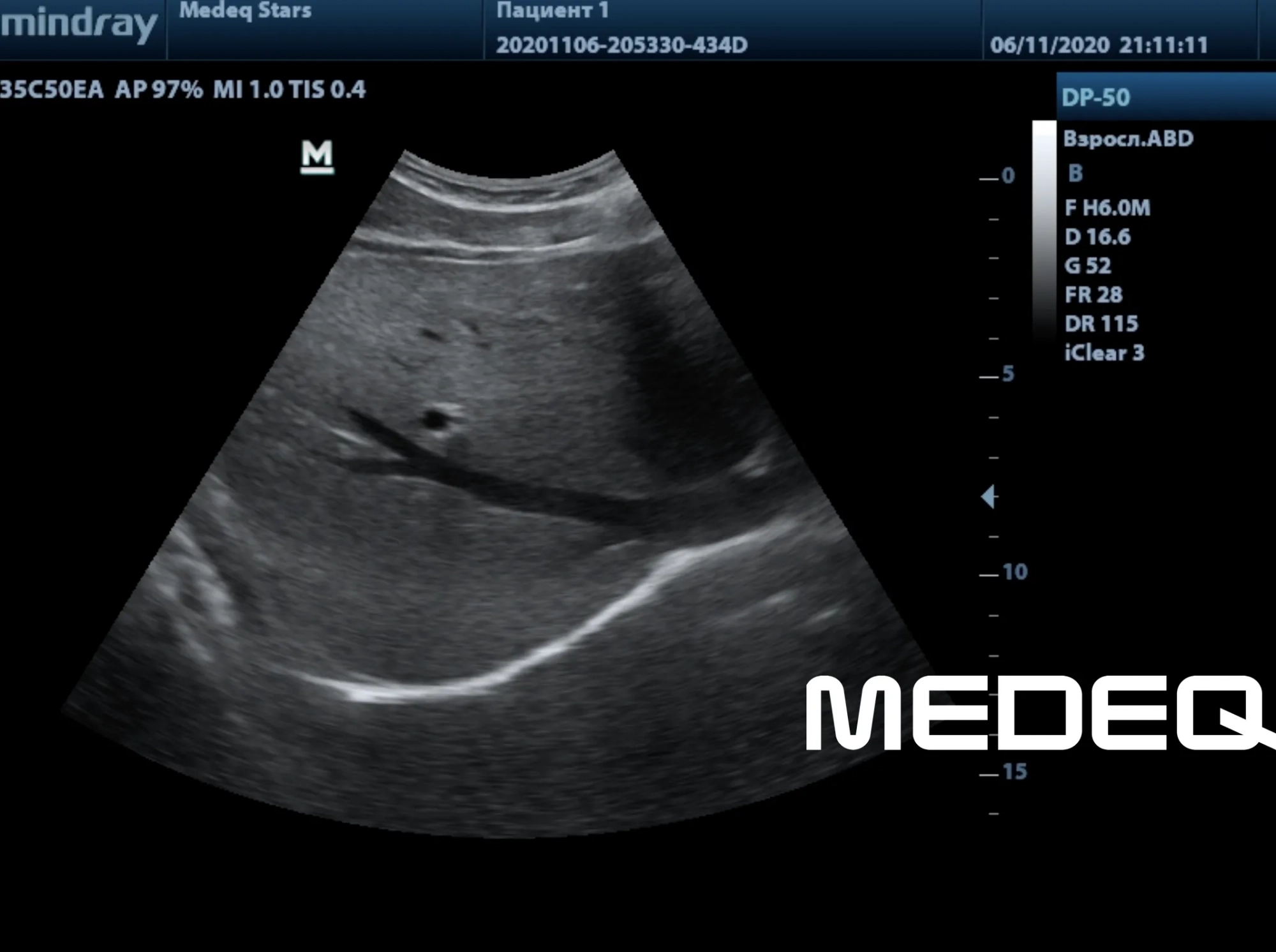 Фото Mindray 35C50EA