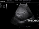 Фото Mindray 3C5s