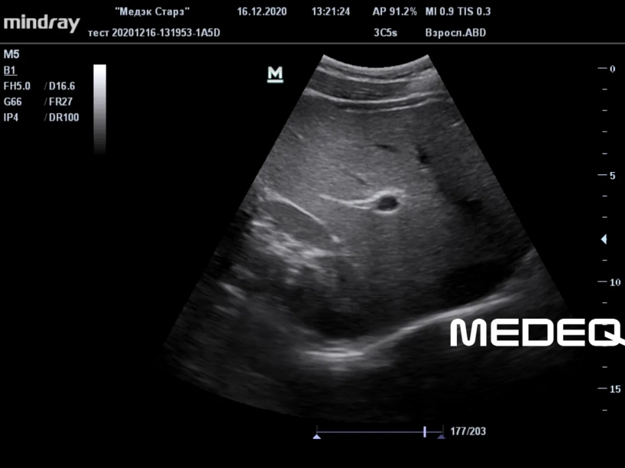 Фото Mindray 3C5s