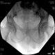 Фото GE Healthcare OEC Elite CFD