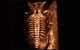 Фото Mindray Imagyn i9