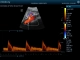 Фото Mindray DC-N2