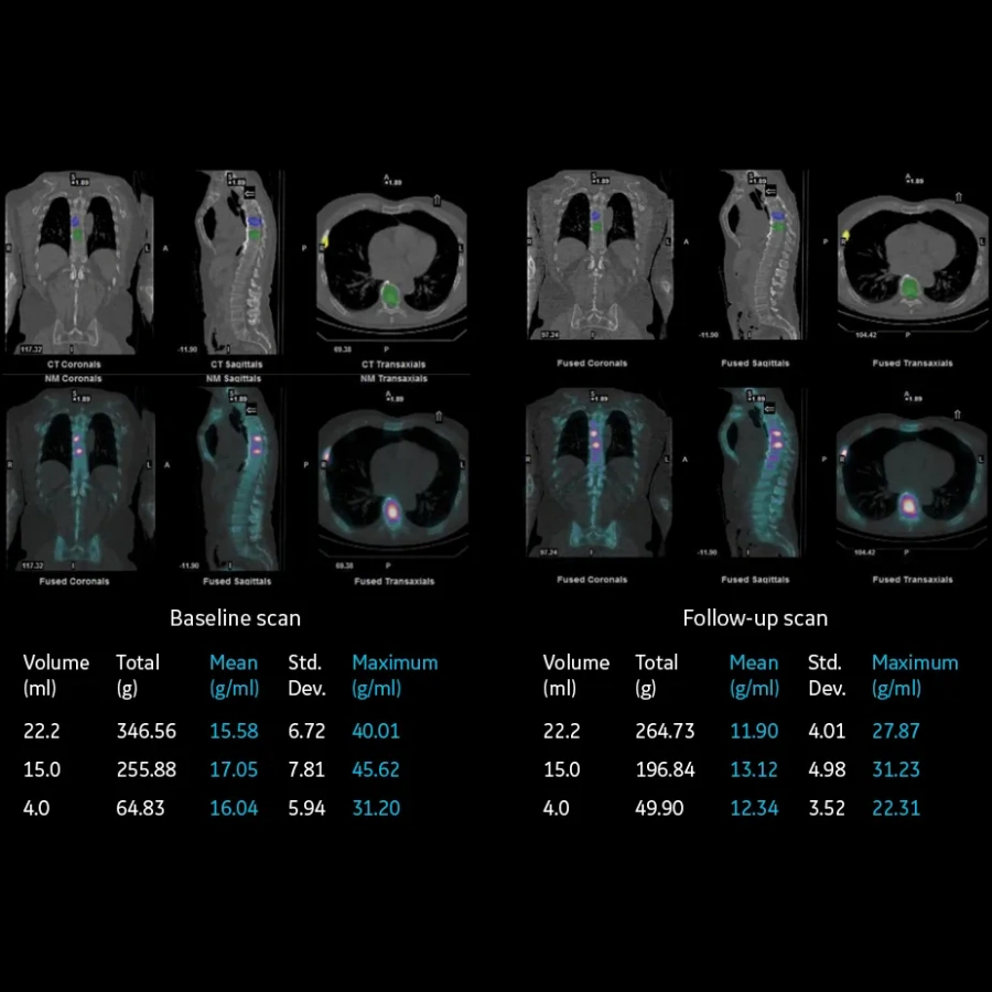 Фото GE Healthcare NM/CT 870 CZT