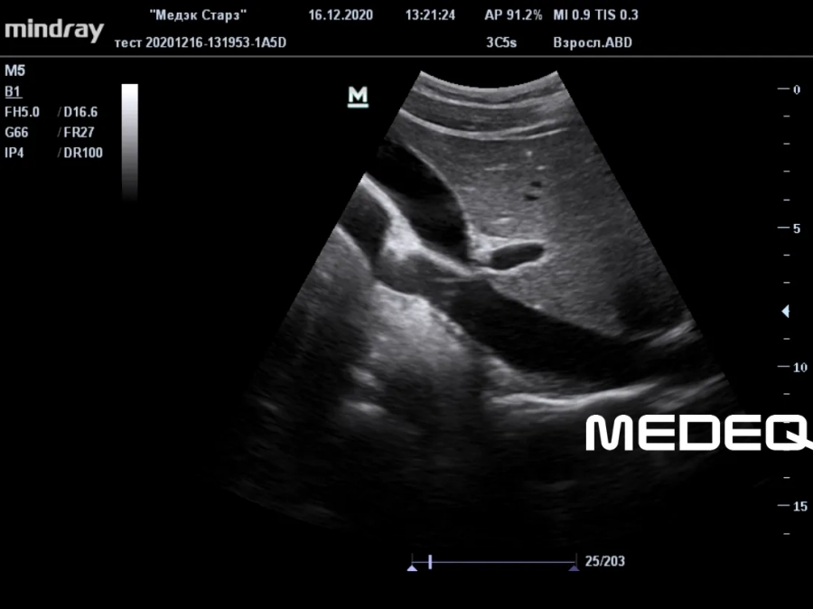 Фото Mindray 3C5s