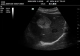 Фото Mindray DC-N6