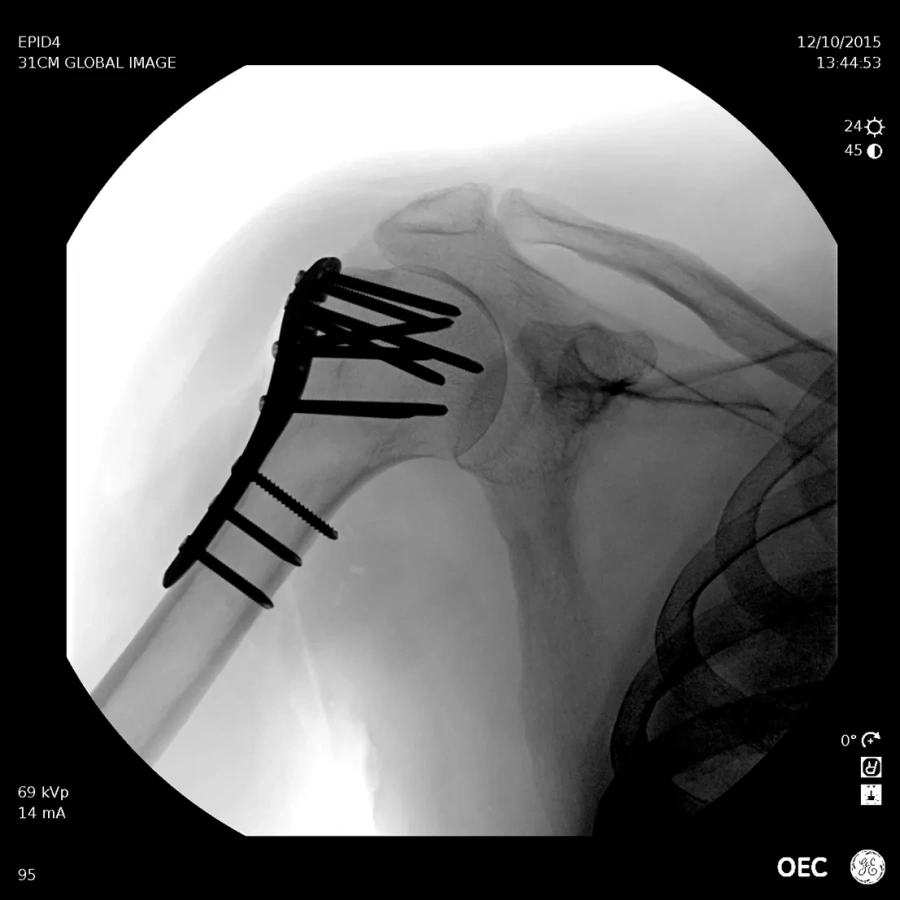 Фото GE Healthcare OEC Elite CFD