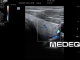 Фото Mindray L14-6s