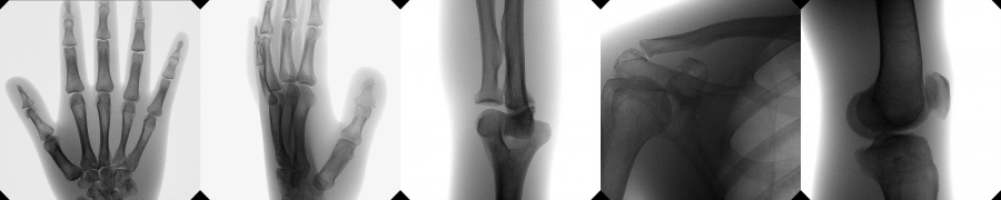 Фото Orthoscan TAU
