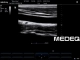 Фото Mindray 7L4s