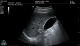 Фото Mindray MX7