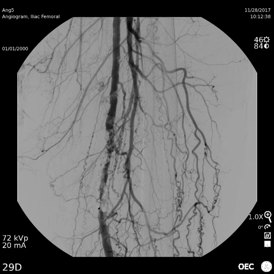 Фото GE Healthcare OEC Elite CFD
