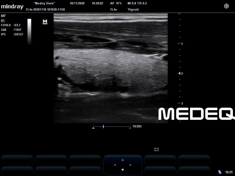 Фото Mindray 7L4s