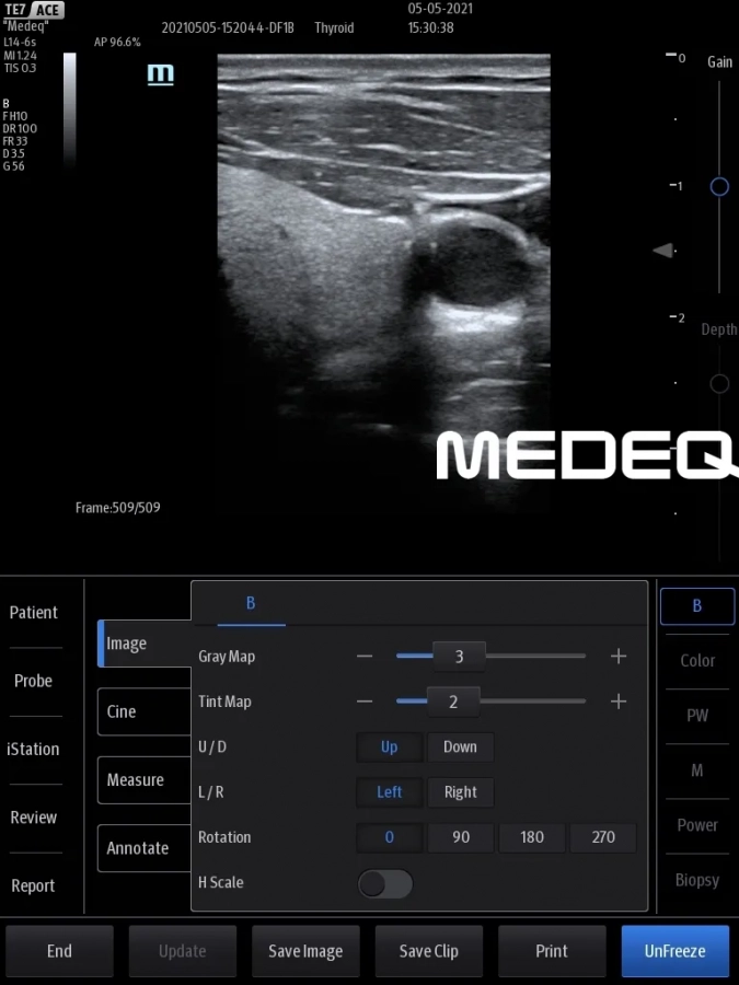 Фото Mindray L14-6s
