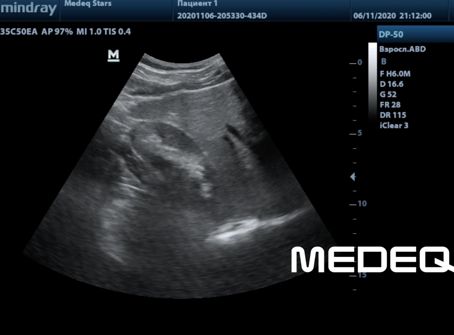Фото Mindray 35C50EA