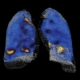 Фото GE Healthcare NM/CT 870 DR
