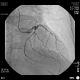 Фото GE Healthcare OEC Elite CFD
