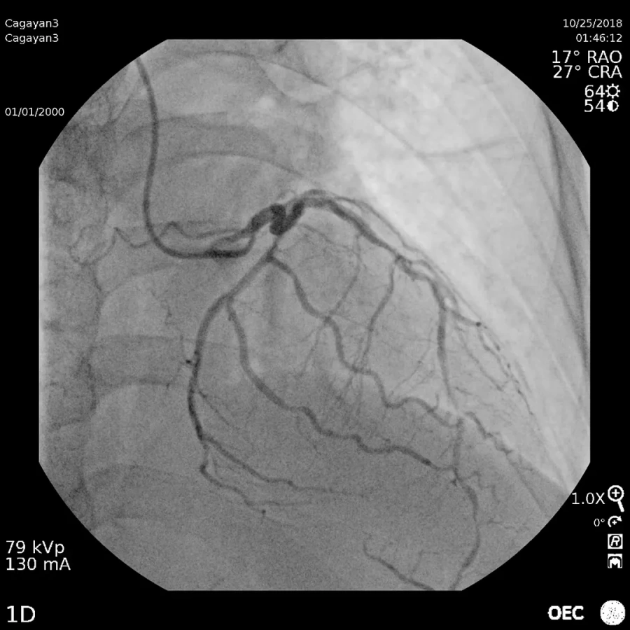 Фото GE Healthcare OEC Elite CFD