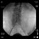 Фото GE Healthcare OEC Elite CFD