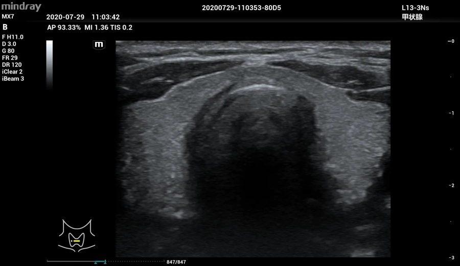 Фото Mindray MX7