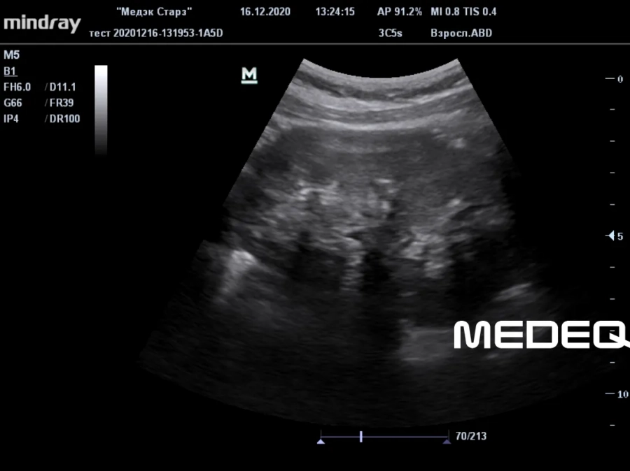 Фото Mindray 3C5s