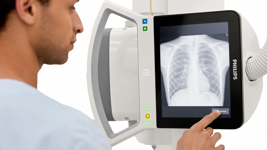 Фото Philips Digital Diagnost C90
