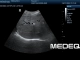 Фото Mindray 35C50EA