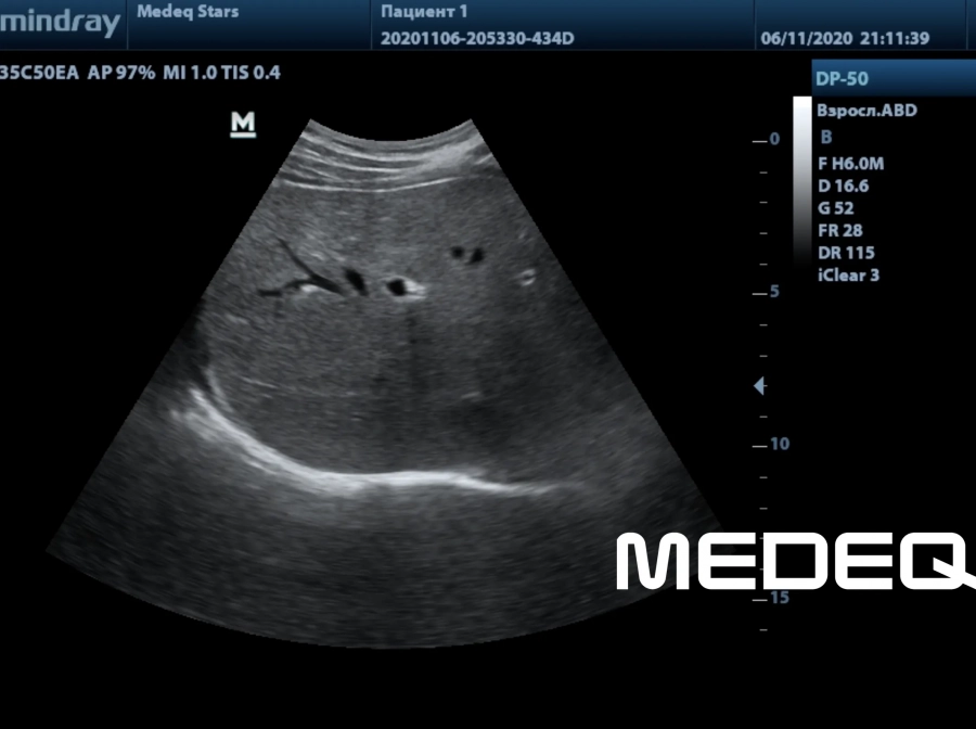 Фото Mindray 35C50EA