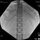 Фото GE Healthcare OEC Elite CFD