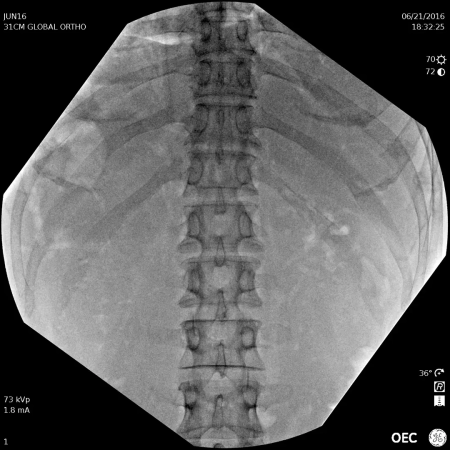Фото GE Healthcare OEC Elite CFD