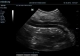 Фото Mindray DC-N3 Vet