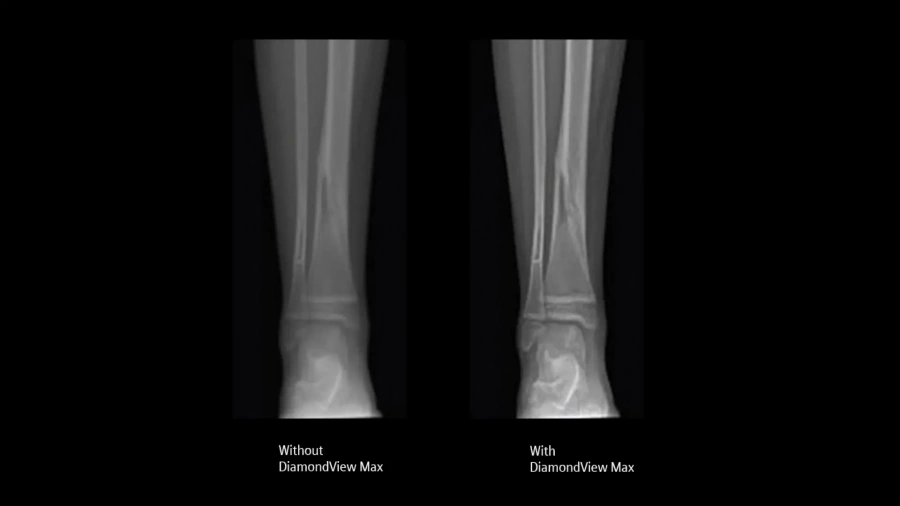 Фото Siemens Mobilett Elara Max